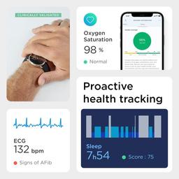 Withings ScanWatch 38mm: ECG & Oximeter Hybrid Smartwatch